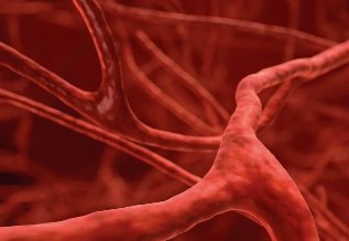 Kako zaščititi vene pred pojavom krčnih žil