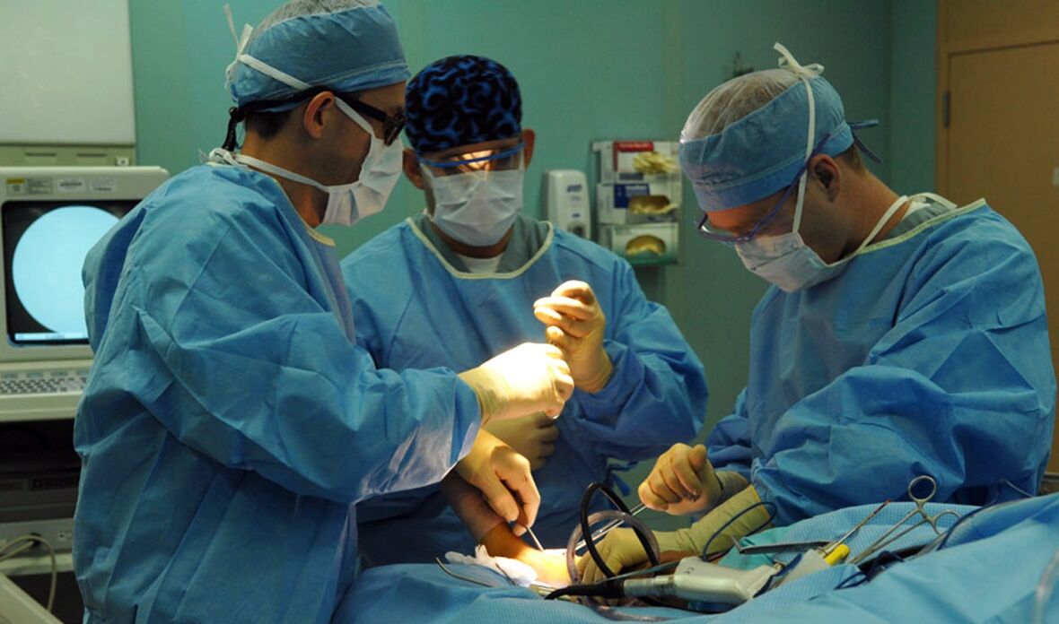 kirurško zdravljenje krčnih žil