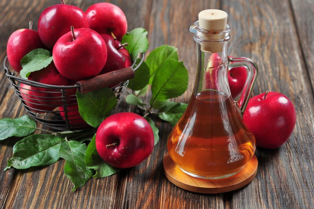 Jabolčni kis za učinkovito zdravljenje krčnih žil