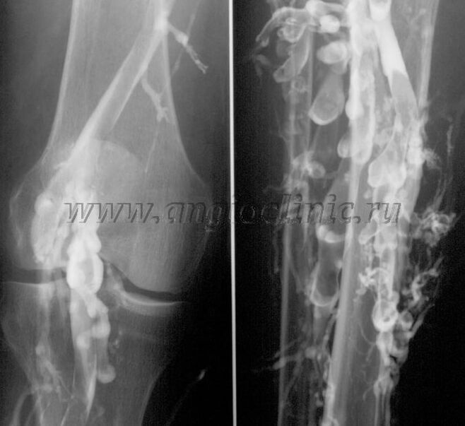 Ultrazvočno skeniranje